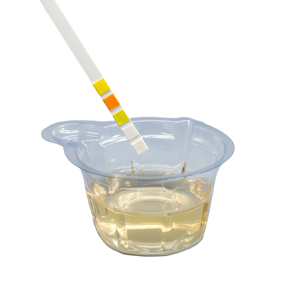 Lifestyle image showing a urine test strip being dipped into urine contained within the collection cup.